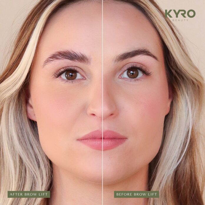imgi_63_kyro_-_before_-_after_-_website_3_048e0493-984e-49a0-95ef-a4c5ed0030bf-1787238723639-b8f619ea